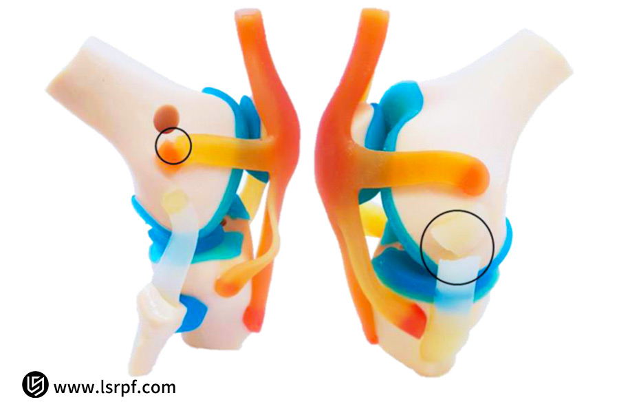 Case study LS: come creare modelli anatomici accurati per la formazione medica?